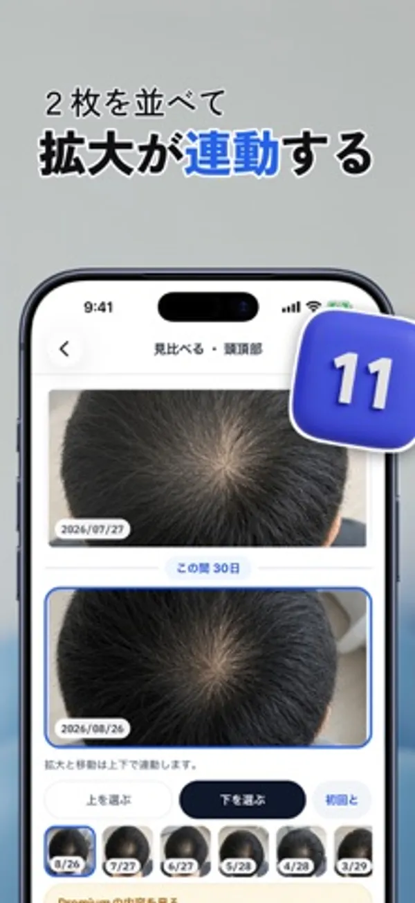 上下に2枚の頭頂部の写真が並び、間に「この間 30日」と表示された比較画面。下に「上を選ぶ」「下を選ぶ」のボタンと日付つきのサムネイルが並ぶ