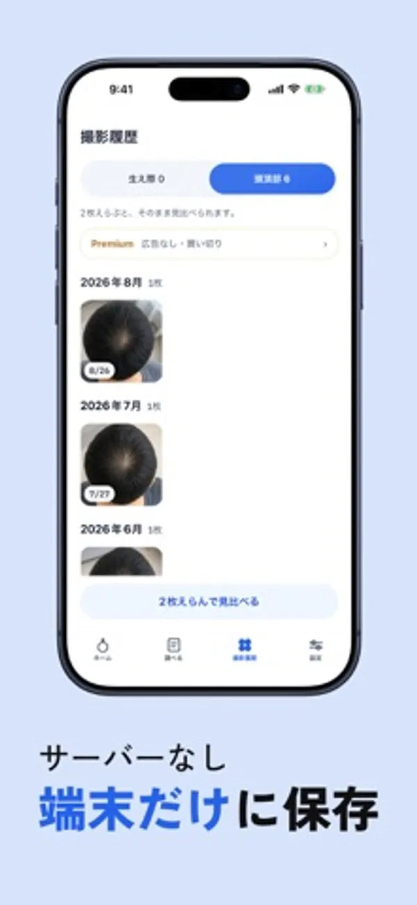 「撮影履歴」の画面。生え際と頭頂部の切り替えタブ、「Premium 広告なし・買い切り」の帯、2026年8月・7月・6月の頭頂部の写真、下に「2枚えらんで見比べる」ボタン